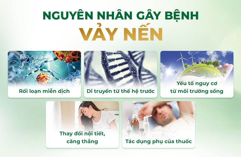 Một số yếu tố tăng nguy cơ mắc vảy nến