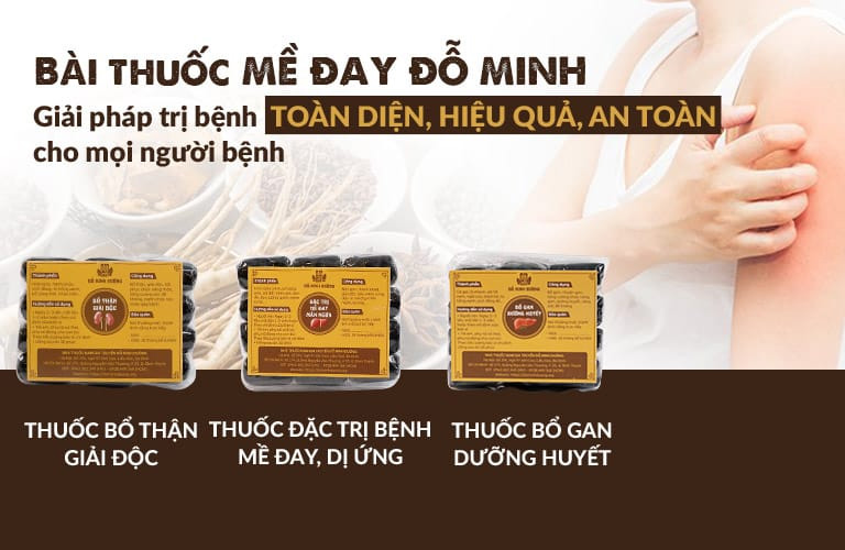 Bài thuốc nam gia truyền của Đỗ Minh Đường chữa dị ứng thời tiết, nổi mề đay