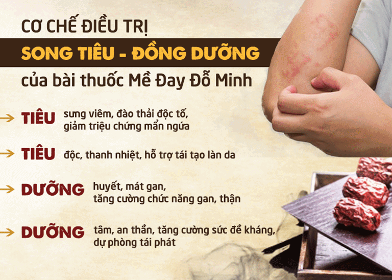 Bài thuốc Mề đay Đỗ Minh hoạt động theo cơ chế Song tiêu - Đồng dưỡng