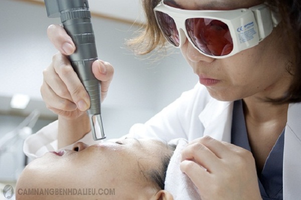 Điều trị mụn đỏ bằng laser hiệu quả nhanh mà không để lại sẹo