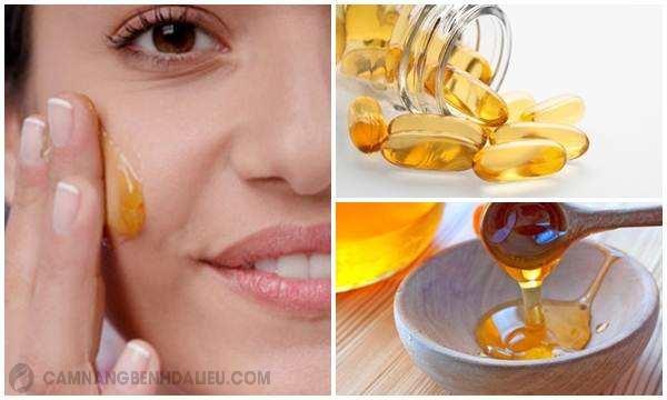 Kết hợp vitamin E và Mật ong đắp mặt nạ trị sẹo rỗ sau mụn