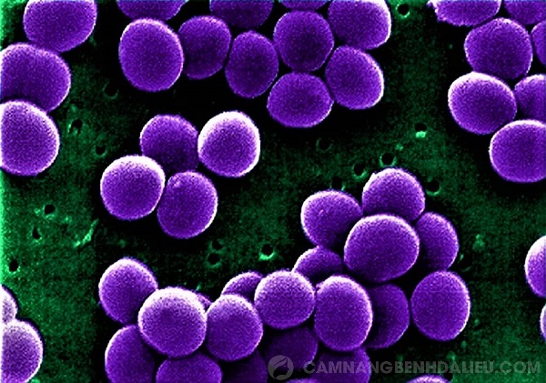 Tụ cầu Staphylococcus aureus dưới kính hiển vi