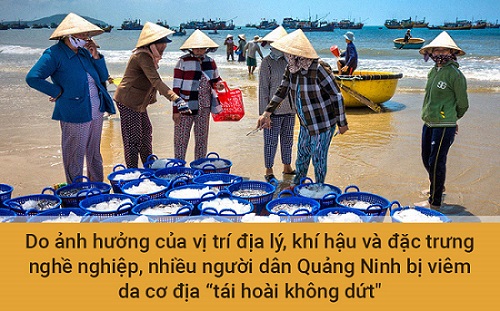 Nguyên nhân bệnh viêm da cơ địa ở Quảng Ninh