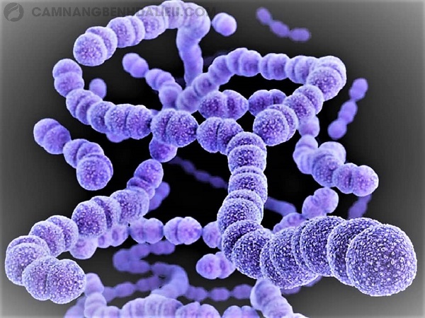 Hình ảnh liên cầu khuẩn Streptococcus pyogenes