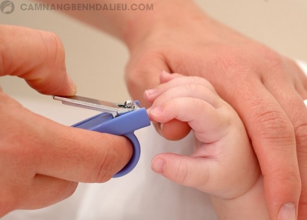 Thường xuyên cắt móng tay cho trẻ để tránh trẻ gãi gây tổn thương vùng chốc lở