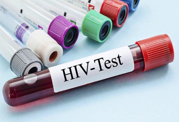 Bệnh lậu không trực tiếp dẫn đến HIV