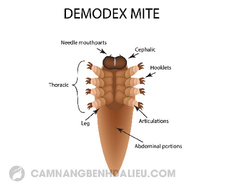 Demodex là một loại ký sinh trùng rất nguy hiểm có thể gây viêm nang lông