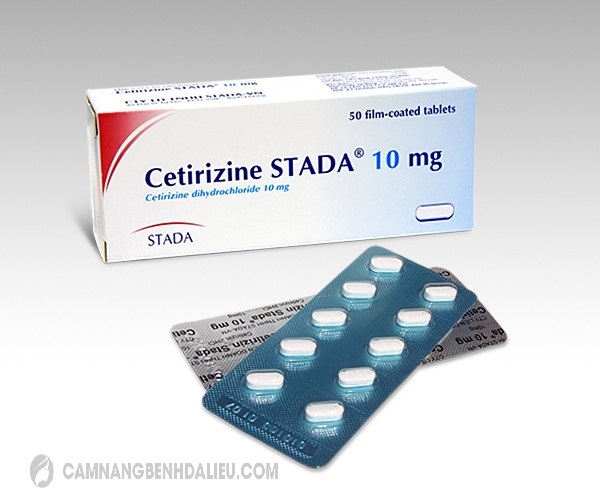 Thuốc Cetirizin Stada 10mg là biệt dược trị bệnh dị ứng, nổi mề đay
