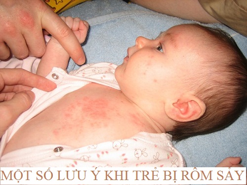Rôm sảy ở trẻ nhỏ nếu không chăm sóc kỹ có thể gây ra nhiễm trùng da