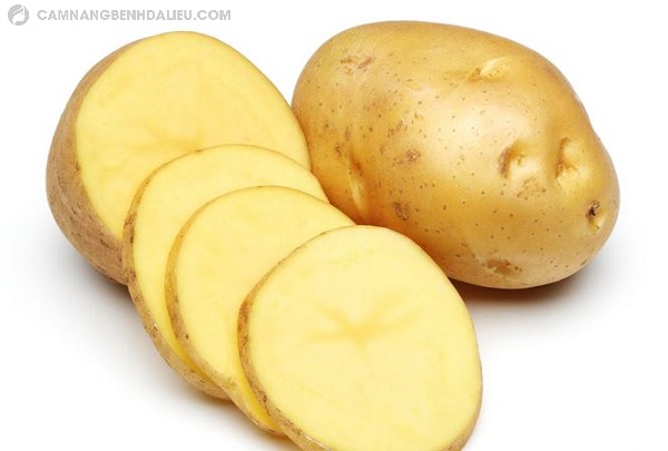 Mẹo chữa dị ứng thời tiết nổi mề đay bằng khoai tây