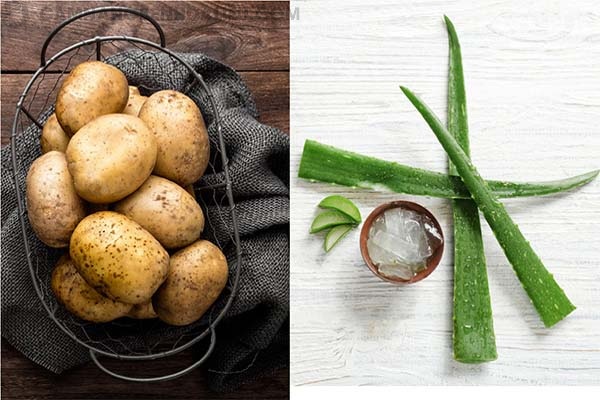 Ngăn ngừa mụn hiệu quả nhờ khoai tây và nha đam