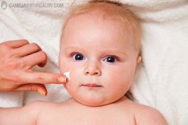 Mẹ không nên tự ý sử dụng kem trị mụn sữa cho trẻ sơ sinh