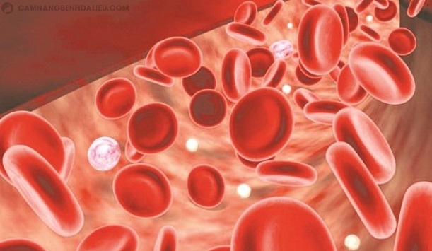 Thiếu máu cũng có thể gây ngứa da