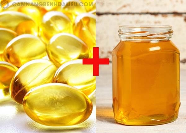 Trị mụn bằng mặt ong và vitamin E