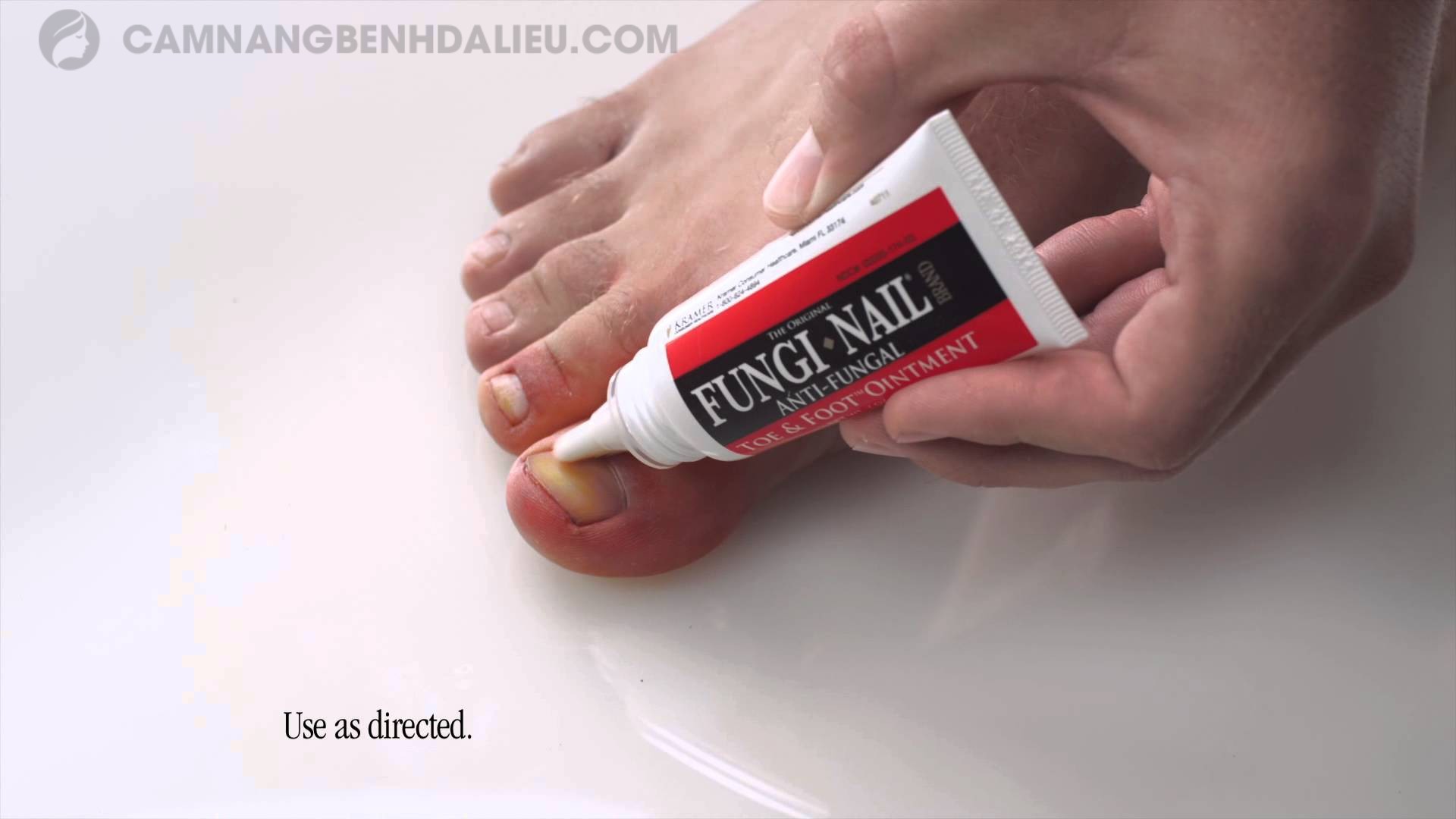 Fungi-Nail Antifungal Nail & Athlete's Foot Ointment — Mountainside Medical  Equipment