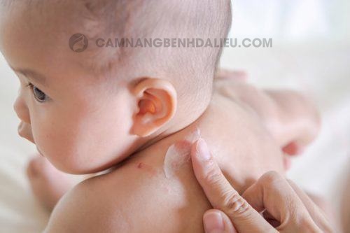thuốc Genskinol trị chàm không sử dụng cho trẻ sơ sinh